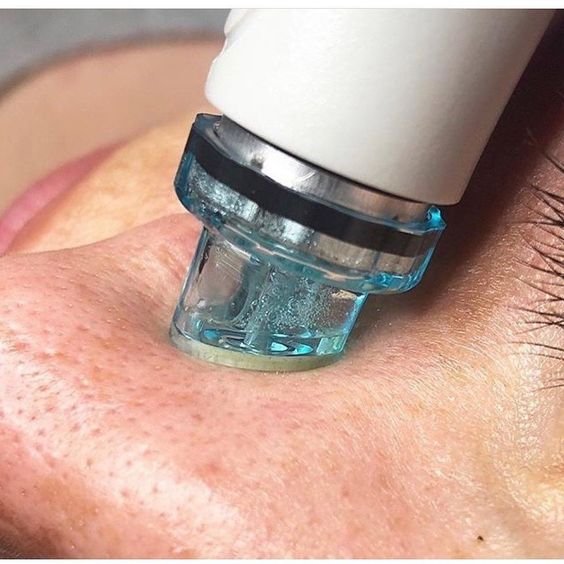 Hydrafacials 101